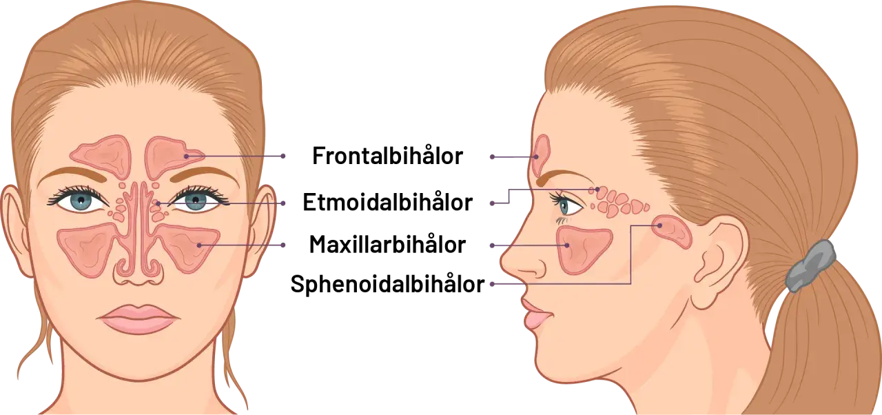 Illustration av bihålorna i ansiktet. Kan visa hur tandproblem kan leda till dental sinuit.