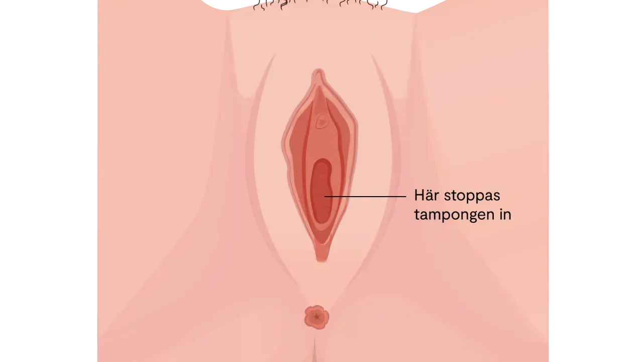 Illustration av kvinnliga könsorgan med texten "Här stoppas tampongen in". Det kan kännas som att det bubblar i underlivet vid mens.