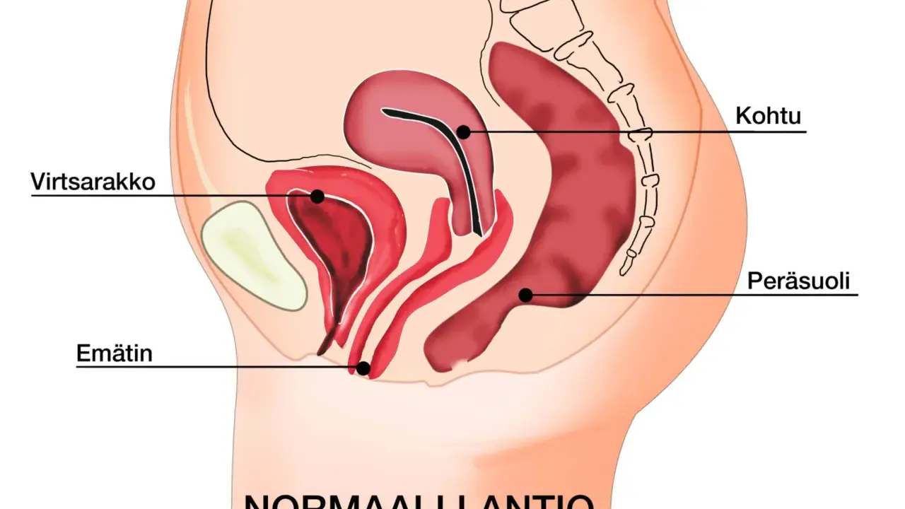 Illustration av normalt bäcken med livmoder, urinblåsa och ändtarm. Kan ge en förståelse för varför man kan ha ont i magen vid framfall.