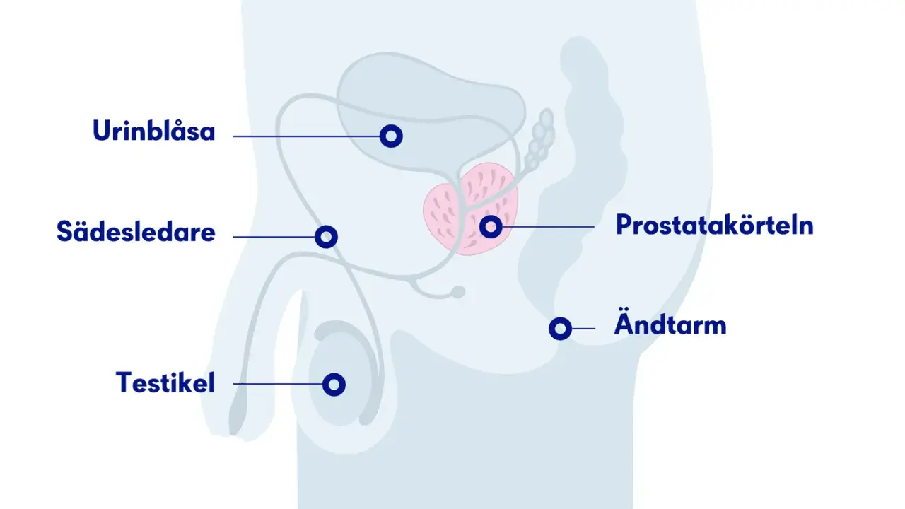 Illustration av manliga könsorgan med urinblåsa, sädesledare, testikel, prostata och ändtarm. En mellangården kvinna kan också ha en prostata.