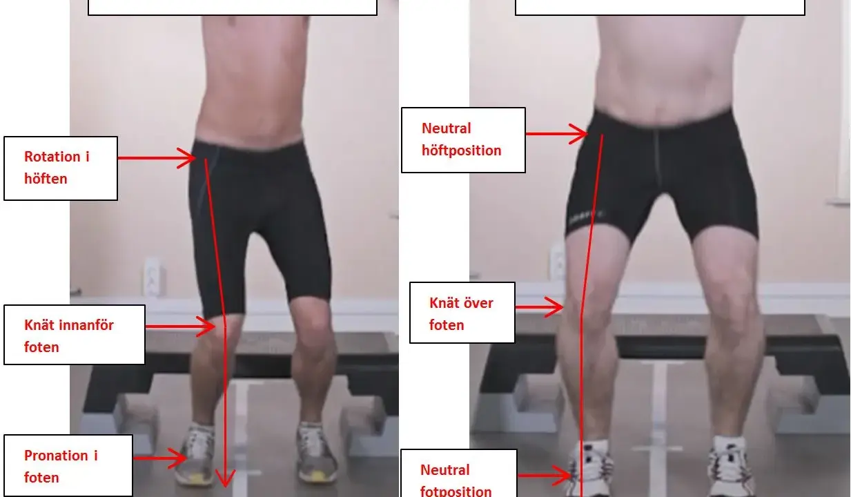 Jämförelse av rörelsekvalitet: Nedsatt med rotation i höften, knä inåt och pronation, jämfört med optimal med neutral höft, knä över fot och neutral fotposition. Kan vara relaterat till en acl skada.