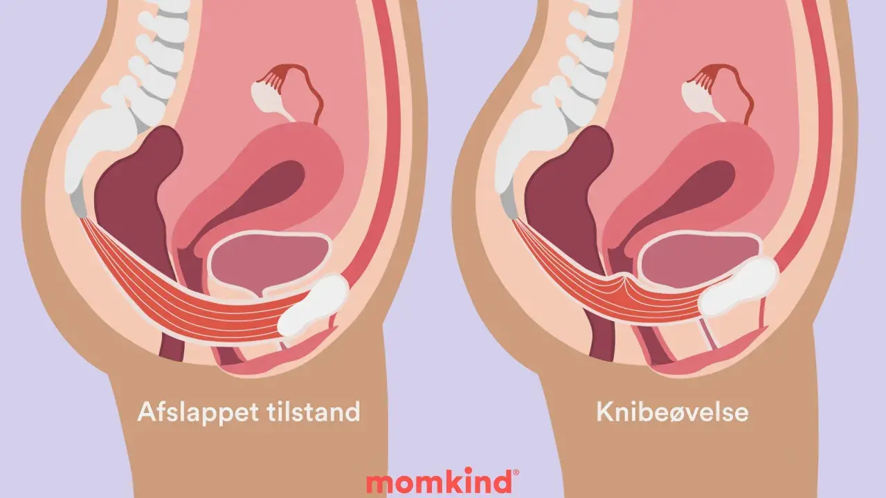 Illustration visar bäckenbotten i avslappnat och kontraherat läge. Träning kan hjälpa mot foglossning blygdbenet.