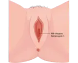 Illustration av kvinnliga könsorgan med texten "Här stoppas tampongen in". Det kan kännas som att det bubblar i underlivet vid mens.