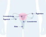 Illustration av kvinnans reproduktionsorgan med livmoder, äggstockar, äggledare, livmoderhals och slida. Kan visa potentiella biverkningar efter hysterektomi.