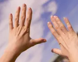 Två händer med sneda fingrar, kanske ett tecken på reumatism, sträcks mot en blå himmel med moln.