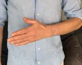Man visar sin hand, tummen är böjd. Kan vara relaterat till senskideinflammation tumme.