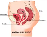 Illustration av normalt bäcken med livmoder, urinblåsa och ändtarm. Kan ge en förståelse för varför man kan ha ont i magen vid framfall.