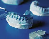 Tandläkarmodeller visar en bettskena för barn, gjord av genomskinligt plastmaterial, som passar över en gipsavgjutning av tänder.