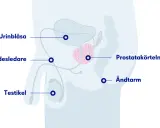 Illustration av manliga könsorgan med urinblåsa, sädesledare, testikel, prostata och ändtarm. En mellangården kvinna kan också ha en prostata.
