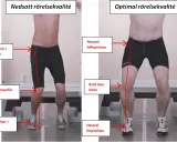 Jämförelse av rörelsekvalitet: Nedsatt med rotation i höften, knä inåt och pronation, jämfört med optimal med neutral höft, knä över fot och neutral fotposition. Kan vara relaterat till en acl skada.