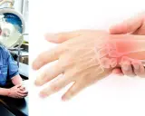 Läkare undersöker en stukad handled utan svullnad, med en illustration av benen som visar smärtområdet.