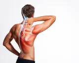 Man med smärta i axel och nacke, illustrerad med röda muskler och blå nerver. Möjliga impingement axel symtom.