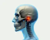 Detaljerad vy av ett mänskligt kranium och halsrygg, med fokus på käkleden där tuberculum articulare lyser rött, vilket indikerar en potentiell smärtpunkt.