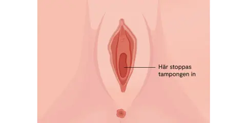 Illustration av kvinnliga könsorgan med texten "Här stoppas tampongen in". Det kan kännas som att det bubblar i underlivet vid mens.