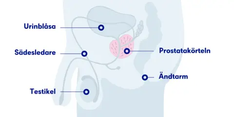 Illustration av manliga könsorgan med urinblåsa, sädesledare, testikel, prostata och ändtarm. En mellangården kvinna kan också ha en prostata.