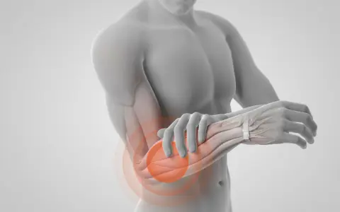 En anatomisk illustration visar muskler i underarmen med en röd cirkel som indikerar smärta.