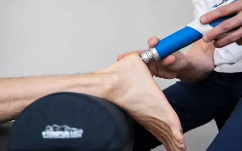 Behandling av plantar fasciit med stötvågsbehandling. En terapeut använder en blå enhet för att behandla en fot.