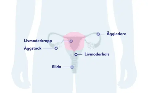 Illustration av kvinnans reproduktionsorgan med livmoder, äggstockar, äggledare, livmoderhals och slida. Kan visa potentiella biverkningar efter hysterektomi.