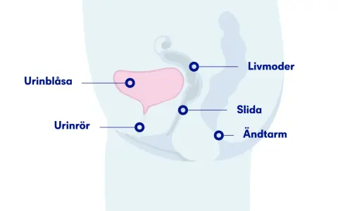 Illustration av bäckenorganen: urinblåsa, livmoder, slida, ändtarm och urinrör. Visar hur ett framfall av urinblåsan kan påverka dessa.