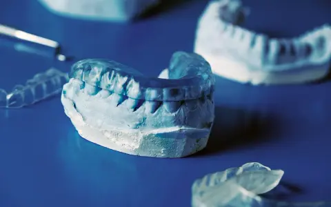 Tandläkarmodeller visar en bettskena för barn, gjord av genomskinligt plastmaterial, som passar över en gipsavgjutning av tänder.