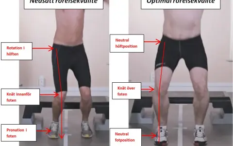 Jämförelse av rörelsekvalitet: Nedsatt med rotation i höften, knä inåt och pronation, jämfört med optimal med neutral höft, knä över fot och neutral fotposition. Kan vara relaterat till en acl skada.