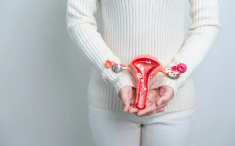 Modell av livmoder med fibrom. Kan en hysterektomi påverka sexlusten?