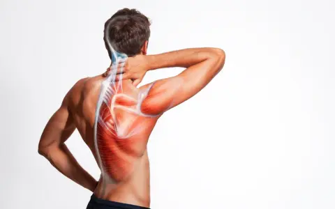 Man med smärta i axel och nacke, illustrerad med röda muskler och blå nerver. Möjliga impingement axel symtom.