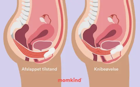 Illustration visar bäckenbottenmuskulaturen i avslappnat och kontraherat läge. Knipövningar är en del av symfysit behandling.