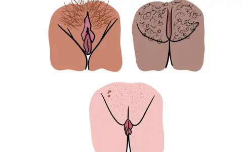 Tre illustrationer visar olika snippa riktig, med varierande mängd könshår och hudtoner.