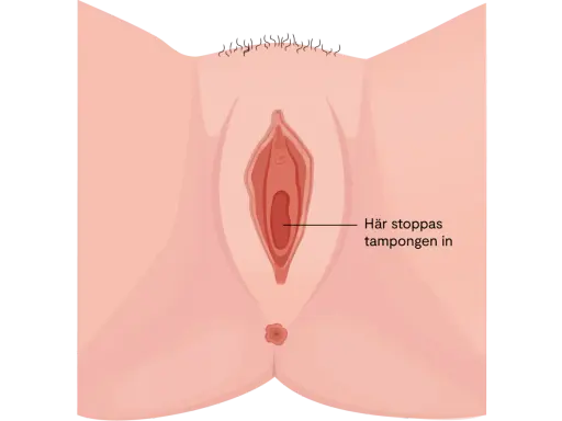 Illustration av kvinnliga könsorgan med texten "Här stoppas tampongen in". Det kan kännas som att det bubblar i underlivet vid mens.