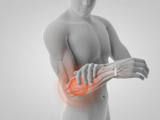 En anatomisk illustration visar muskler i underarmen med en röd cirkel som indikerar smärta.