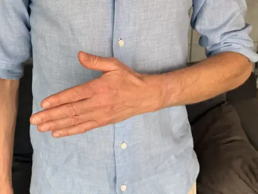 Man visar sin hand, tummen är böjd. Kan vara relaterat till senskideinflammation tumme.