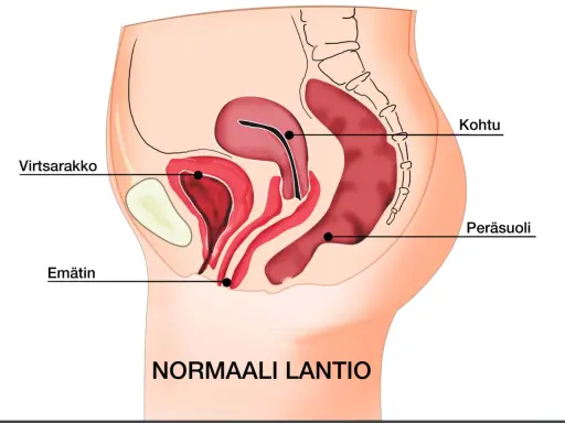 Illustration av normalt bäcken med livmoder, urinblåsa och ändtarm. Kan ge en förståelse för varför man kan ha ont i magen vid framfall.