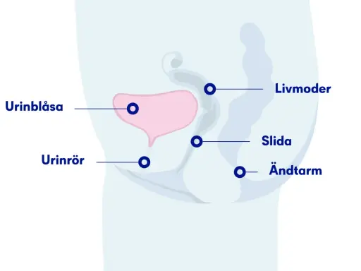 Illustration av bäckenorganen: urinblåsa, livmoder, slida, ändtarm och urinrör. Visar hur ett framfall av urinblåsan kan påverka dessa.