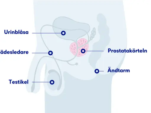 Illustration av manliga könsorgan med urinblåsa, sädesledare, testikel, prostata och ändtarm. En mellangården kvinna kan också ha en prostata.