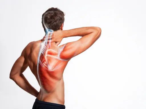 Man med smärta i axel och nacke, illustrerad med röda muskler och blå nerver. Möjliga impingement axel symtom.