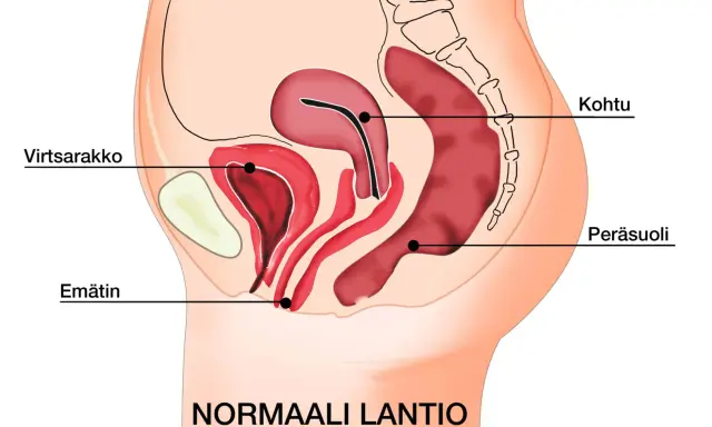 Illustration av normalt bäcken med livmoder, urinblåsa och ändtarm. Kan ge en förståelse för varför man kan ha ont i magen vid framfall.