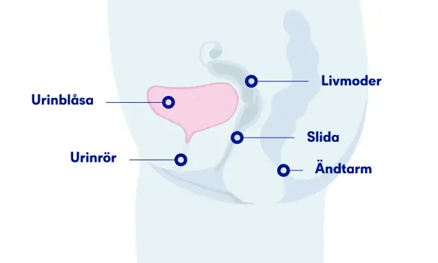 Illustration av bäckenorganen: urinblåsa, livmoder, slida, ändtarm och urinrör. Visar hur ett framfall av urinblåsan kan påverka dessa.