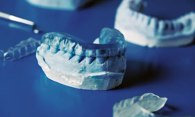 Tandläkarmodeller visar en bettskena för barn, gjord av genomskinligt plastmaterial, som passar över en gipsavgjutning av tänder.