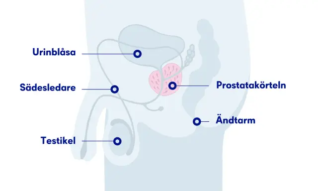 Illustration av manliga könsorgan med urinblåsa, sädesledare, testikel, prostata och ändtarm. En mellangården kvinna kan också ha en prostata.