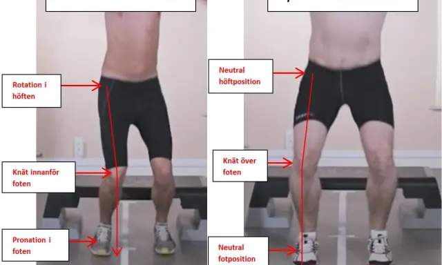 Jämförelse av rörelsekvalitet: Nedsatt med rotation i höften, knä inåt och pronation, jämfört med optimal med neutral höft, knä över fot och neutral fotposition. Kan vara relaterat till en acl skada.