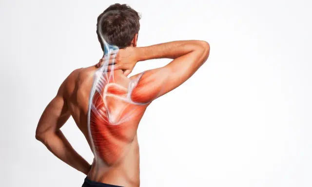 Man med smärta i axel och nacke, illustrerad med röda muskler och blå nerver. Möjliga impingement axel symtom.