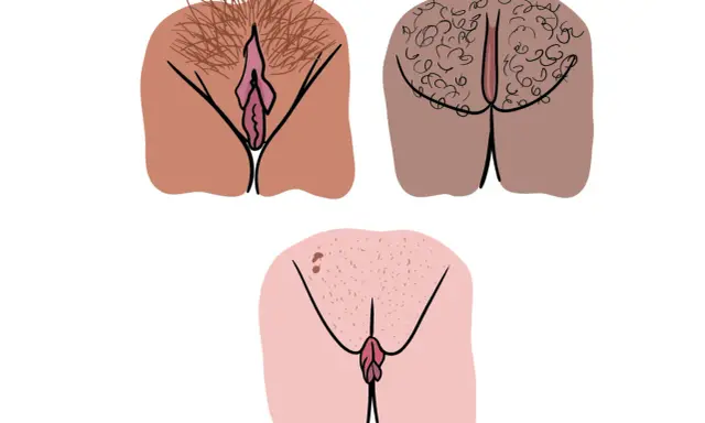 Tre illustrationer visar olika snippa riktig, med varierande mängd könshår och hudtoner.