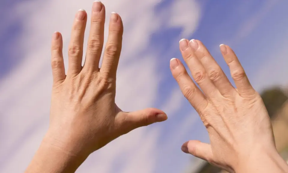 Två händer med sneda fingrar, kanske ett tecken på reumatism, sträcks mot en blå himmel med moln.